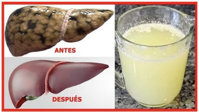 suero-de-leche-para-higado-graso-1-1